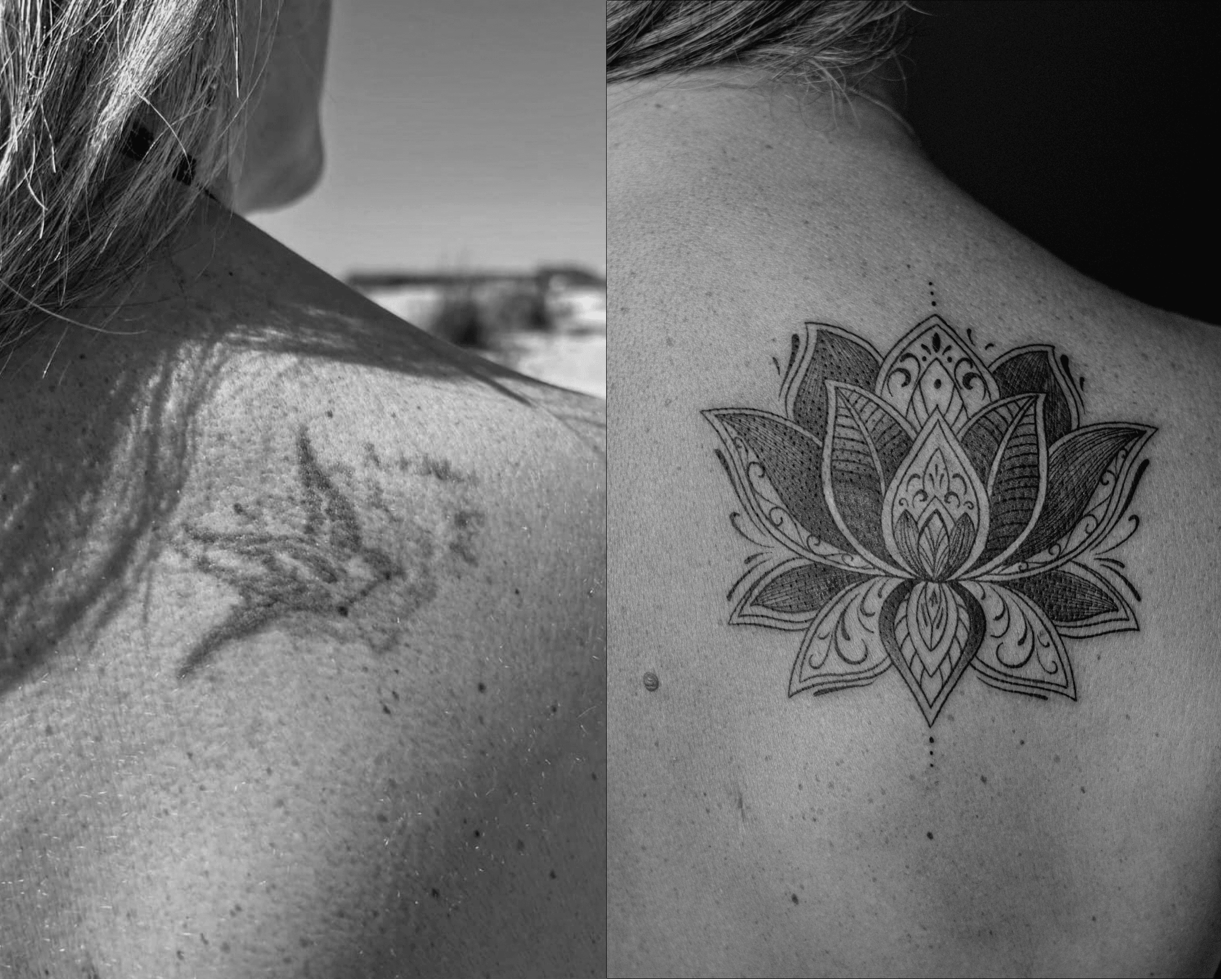 Cover-up made in fineline, on the scapula area, representing a lotus flower, covering an old tattoo.